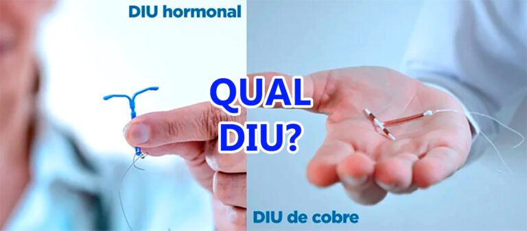 Qual o Melhor DIU? Veja as diferenças do hormonal, cobre e prata